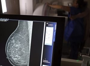 medicos-lancam-guia-para-evitar-recusa-de-mamografia-digital