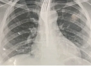 Foto: Imagem Ilustrativa