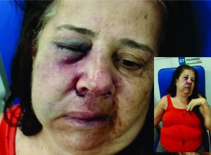 Foto: Redes Sociais | Alerta Sudoeste